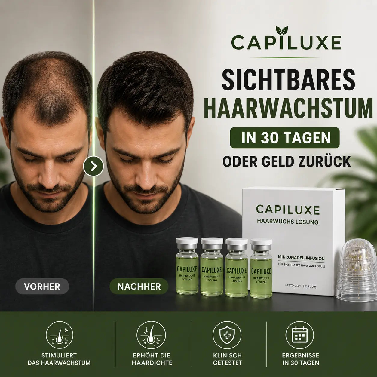 Capiluxe™ Haarregenerations-System